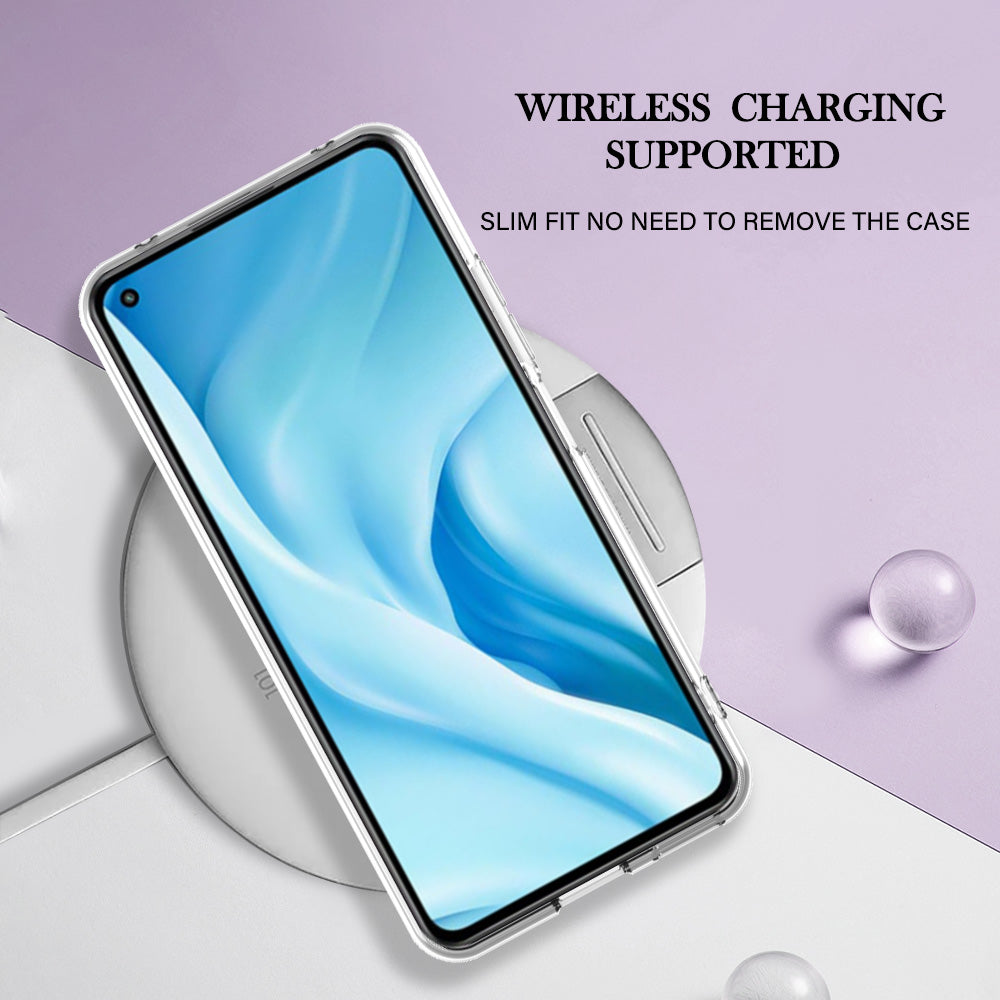 YB IMD Series-16 Style E Phone Case for Xiaomi Mi 11 Lite 4G / 5G / 11 Lite 5G NE , Marble Pattern 2.0mm TPU IMD Cover