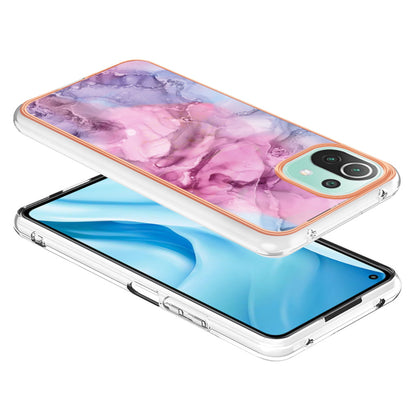 YB IMD Series-16 Style E Phone Case for Xiaomi Mi 11 Lite 4G / 5G / 11 Lite 5G NE , Marble Pattern 2.0mm TPU IMD Cover