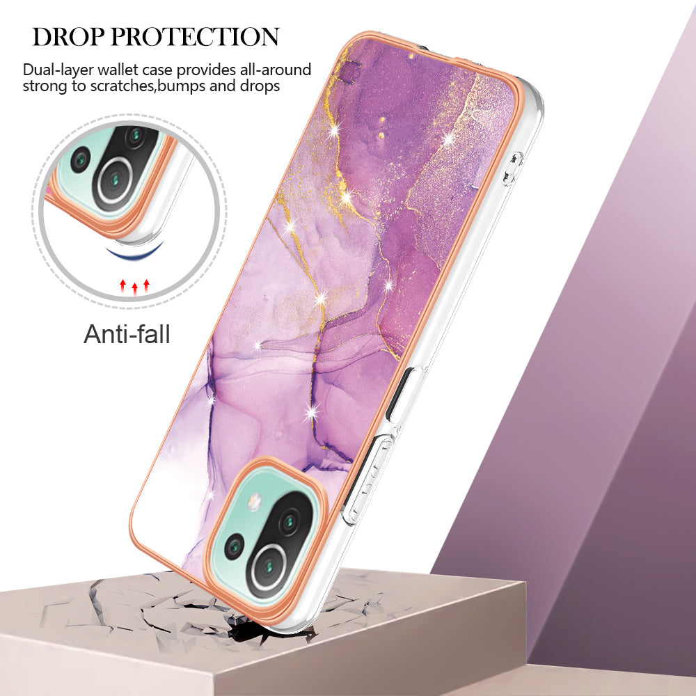 YB IMD Series-2 Marble Pattern Phone Case for Xiaomi Mi 11 Lite 4G / 5G / 11 Lite 5G NE , TPU Electroplated Edge IMD Cover
