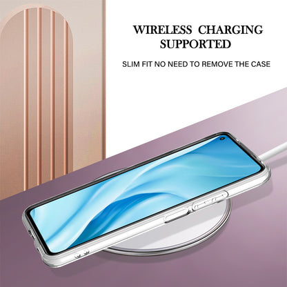YB IMD Series-2 Marble Pattern Phone Case for Xiaomi Mi 11 Lite 4G / 5G / 11 Lite 5G NE , TPU Electroplated Edge IMD Cover