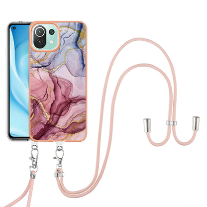 YB IMD Series-18 Style E Phone Case for Xiaomi Mi 11 Lite 4G / 5G / 11 Lite 5G NE , Marble Pattern IMD 2.0mm TPU Cover with Lanyard